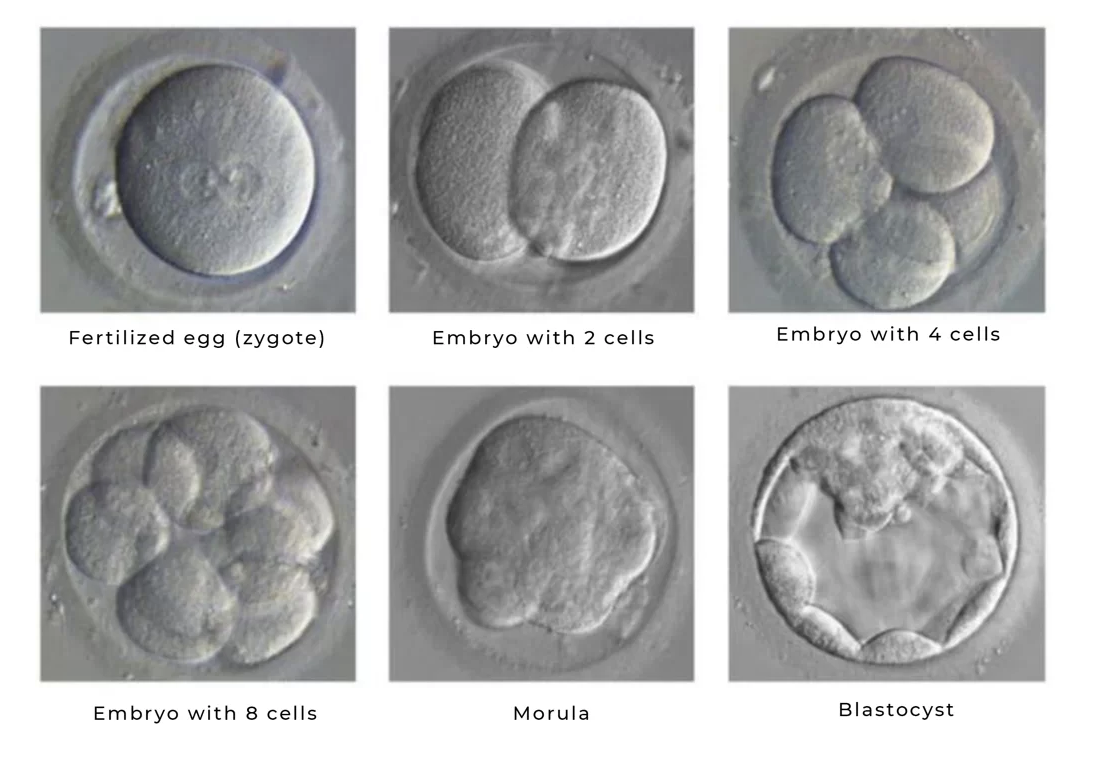 Egg collection