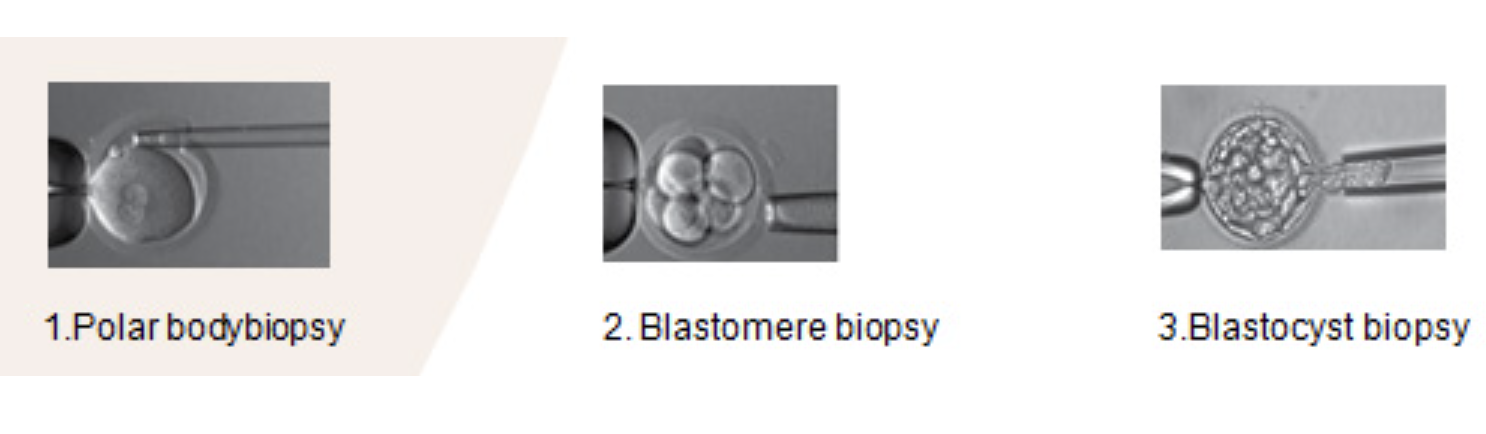 Preimplantation genetic diagnosis